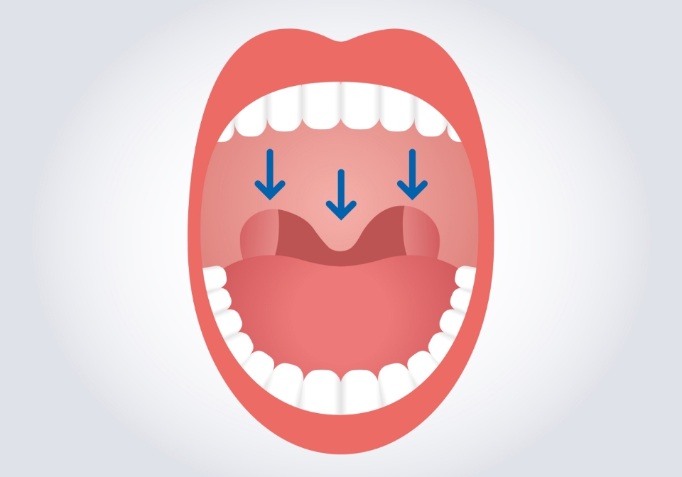 いびきをかきやすくなった喉のイラスト